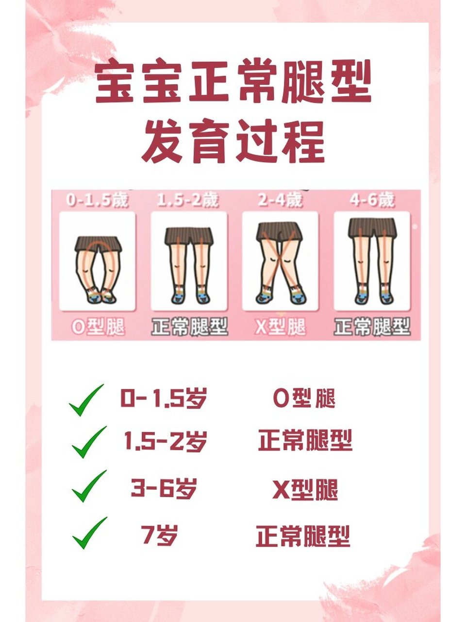 宝宝腿型发育过程图片