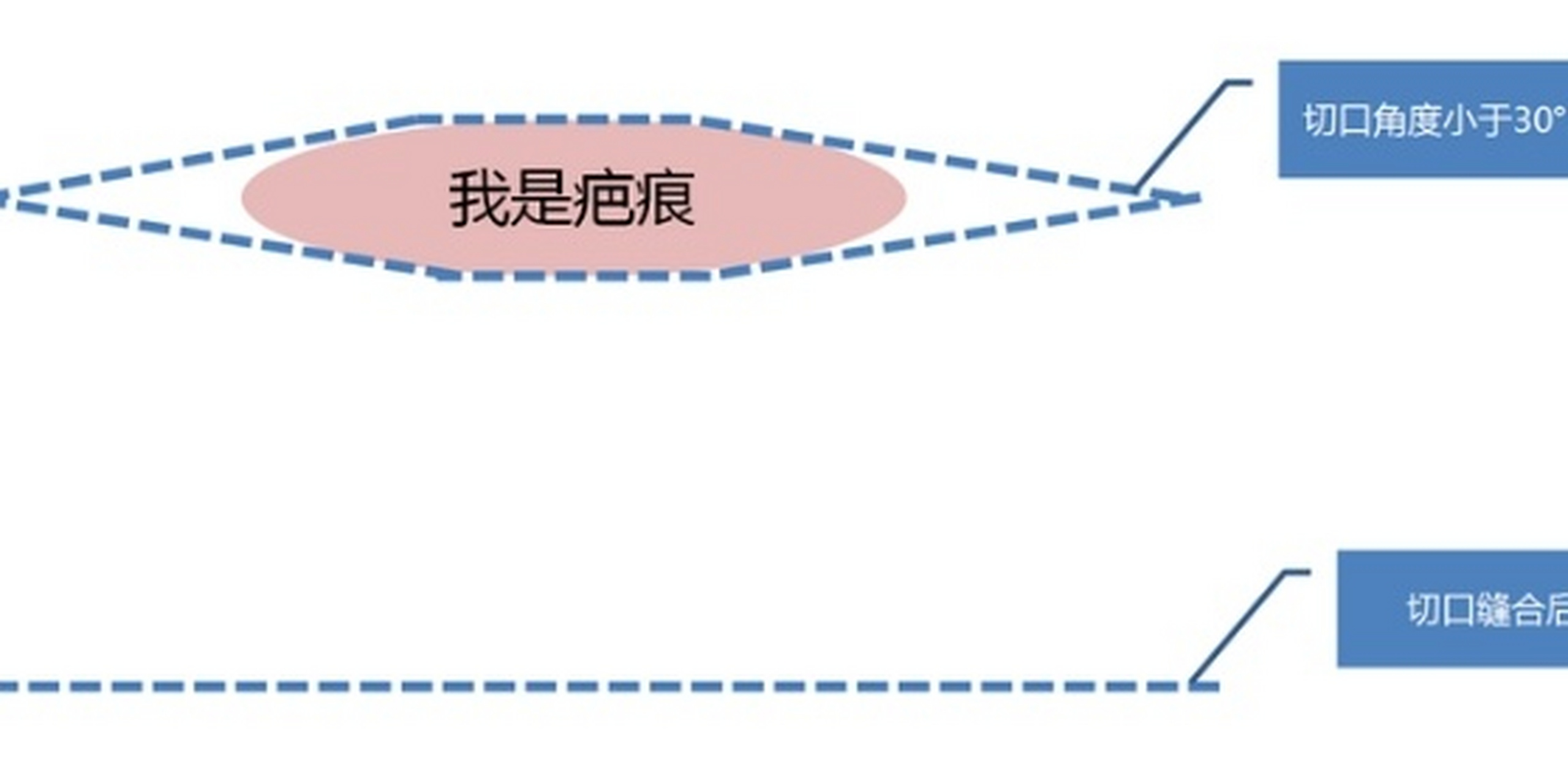 缝合出现猫耳朵图片图片