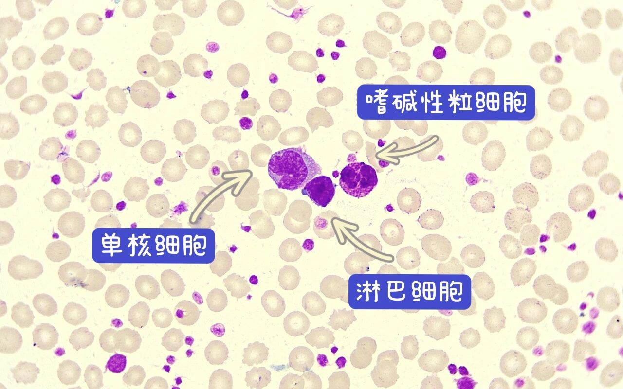 嗜碱性粒细胞工作细胞图片