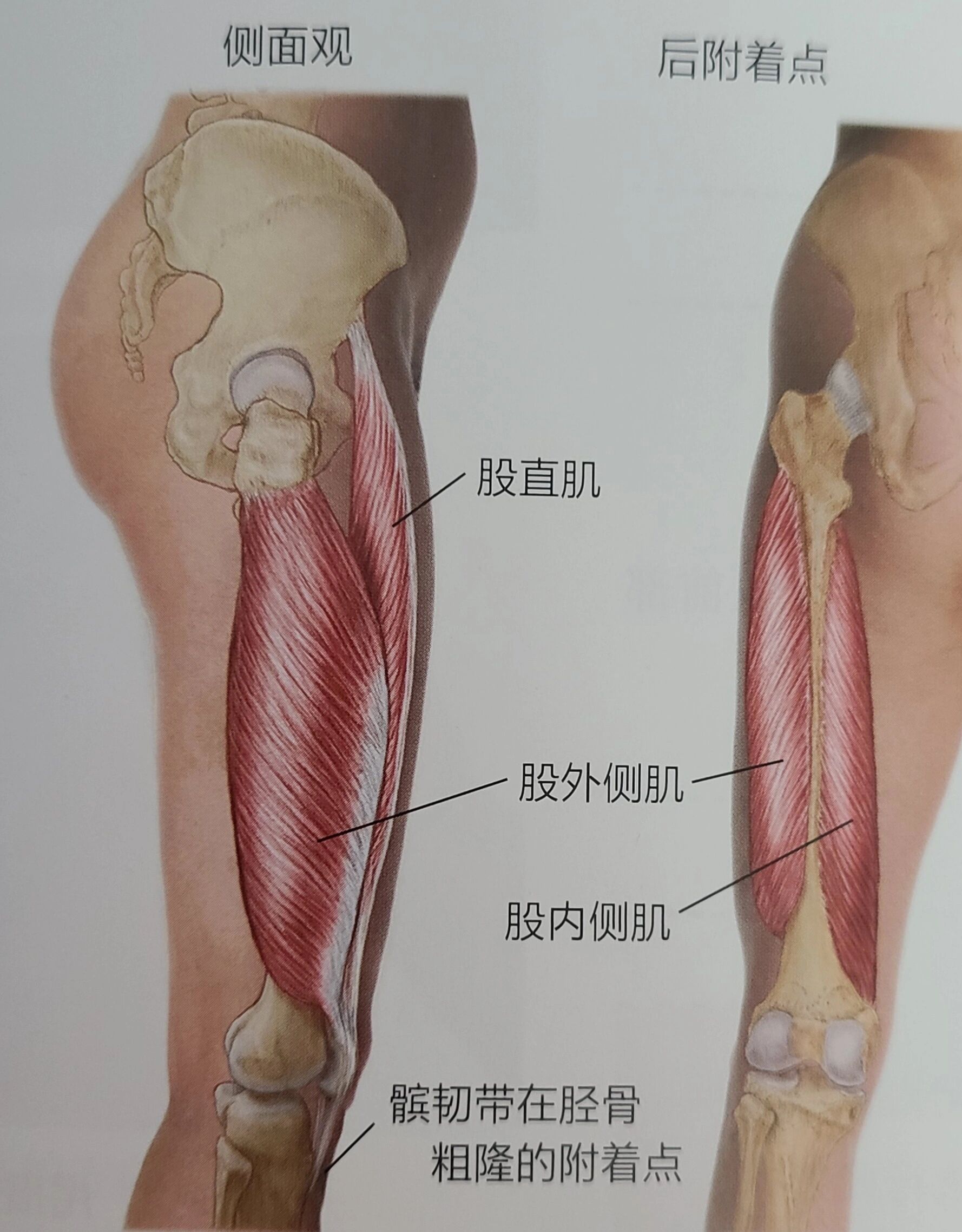 大腿外侧肌腱图图片