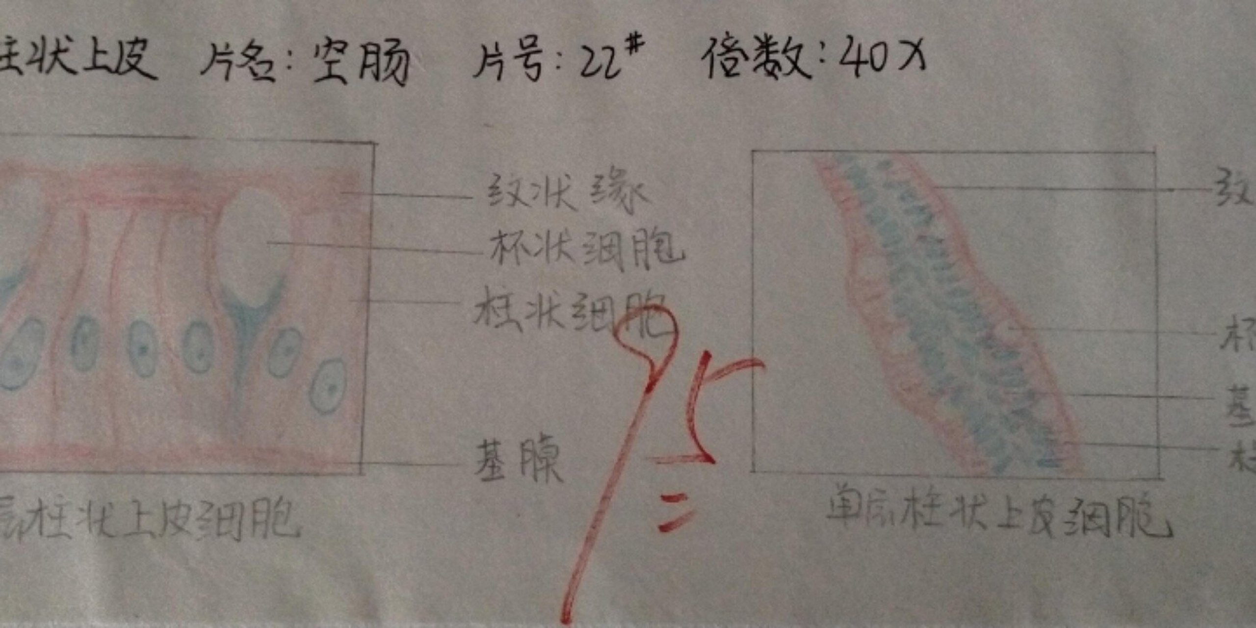 单层柱状上皮绘图4×10图片