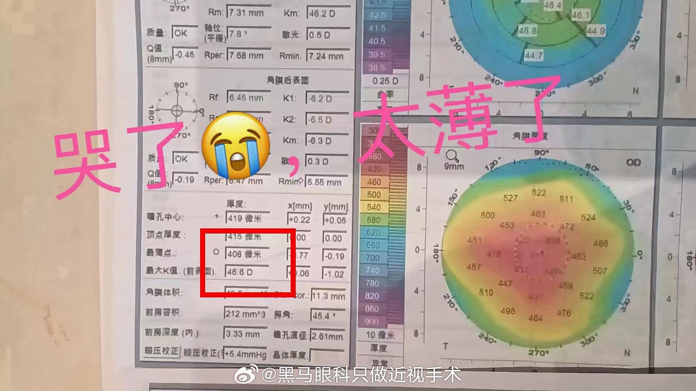 哭了,本来准备今天检查明天手术的患者,角膜厚度检测只有408,告别激光