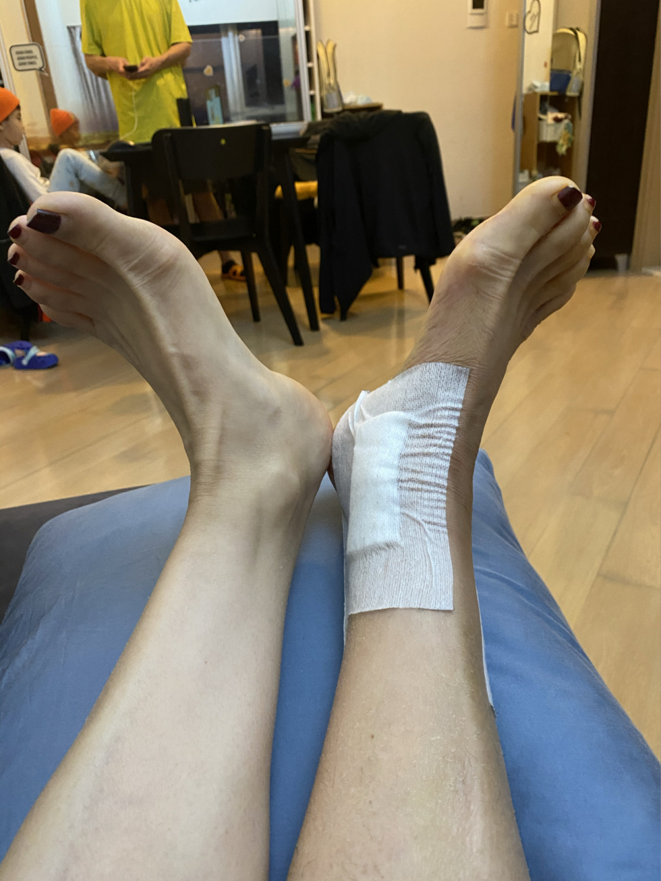 三踝骨折手术16天,复查都正常,勾脚可以超过90度了.期待能走.