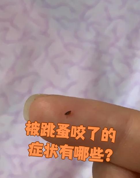 被跳蚤咬了的症状有哪些?