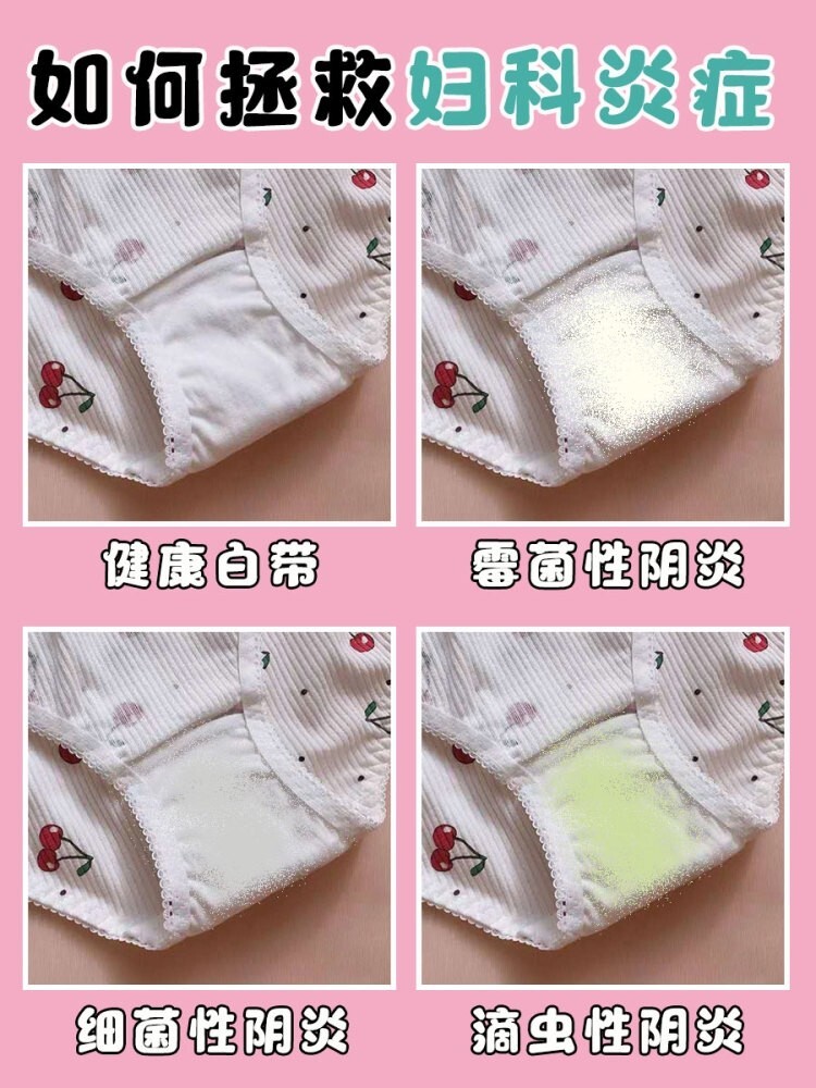 有没有霉菌性阴道炎,通过白带就能看出来 对于女性来说,有白带异常的
