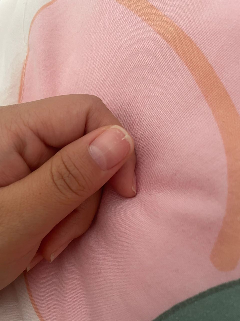 指甲盖中间有一条竖线,张长就顺着线裂开 救命呀,指甲盖上面有一条