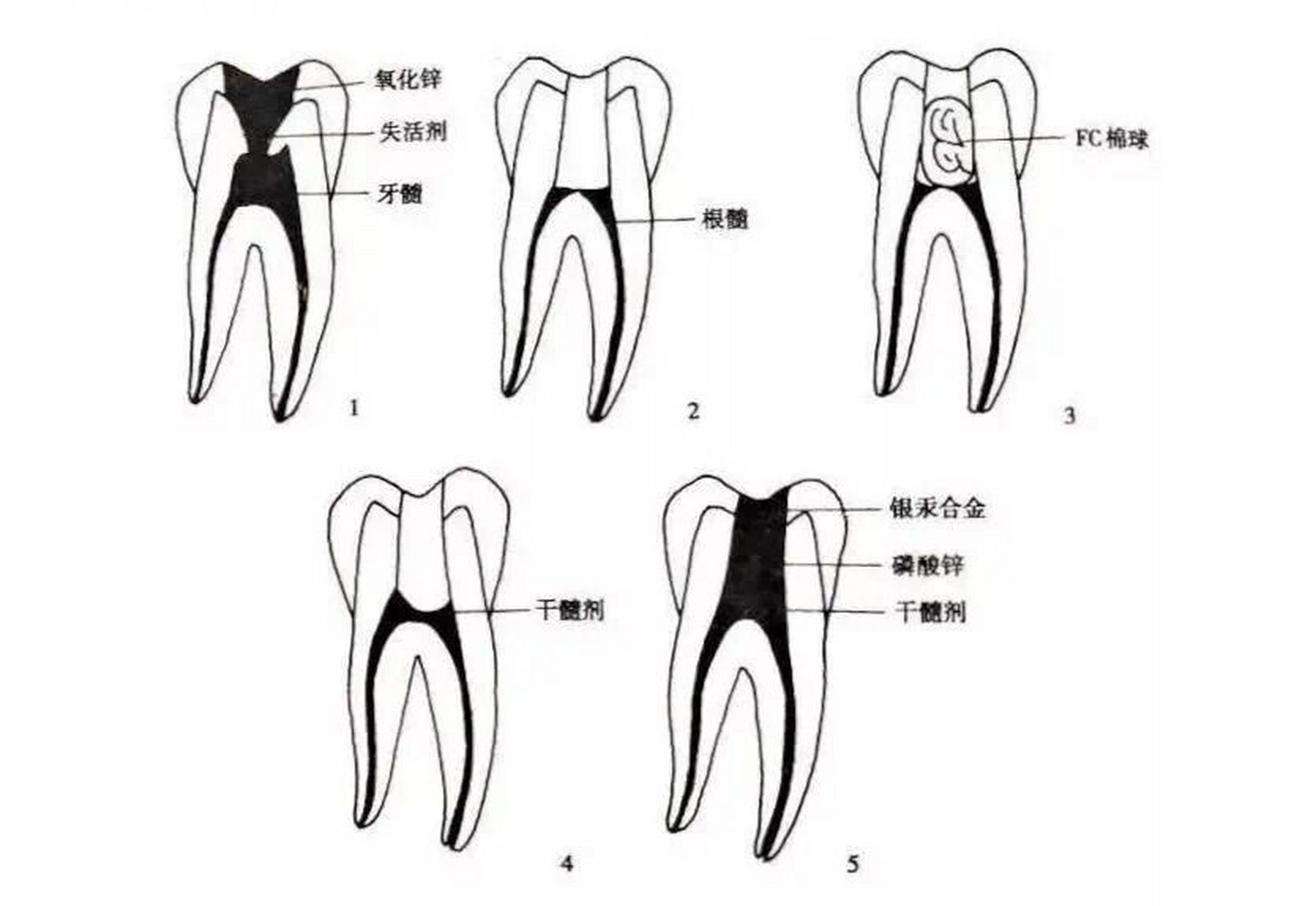 髓索和髓窦图片