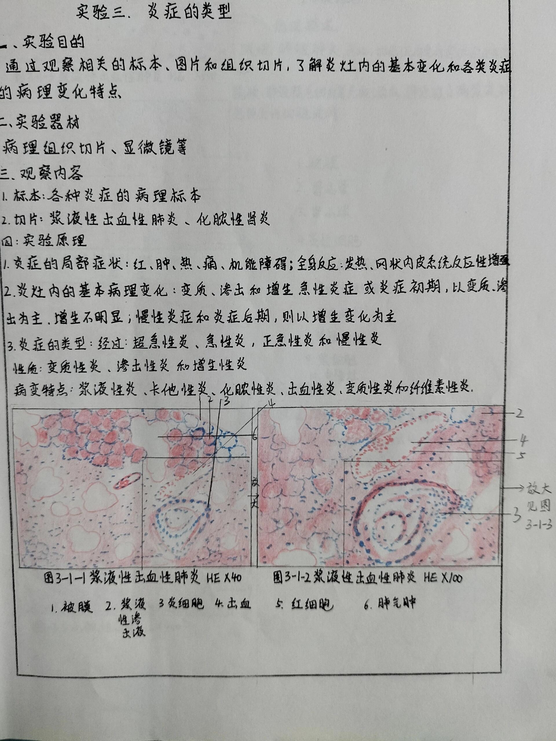 化脓性肾炎切片图片