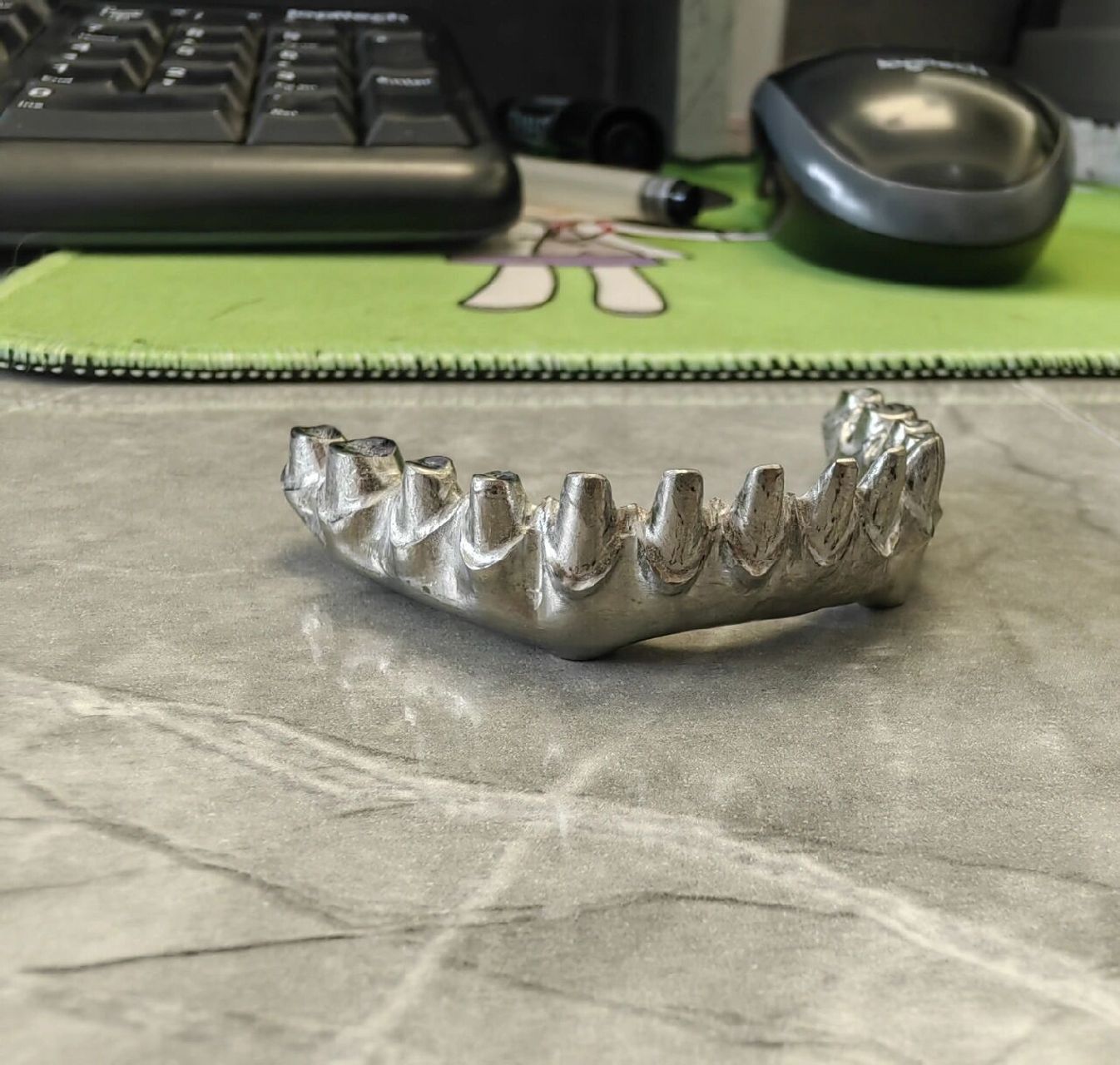 半口种植使用桥架的好处 半口种植牙桥架的好处: 稳定牢固,检修容易