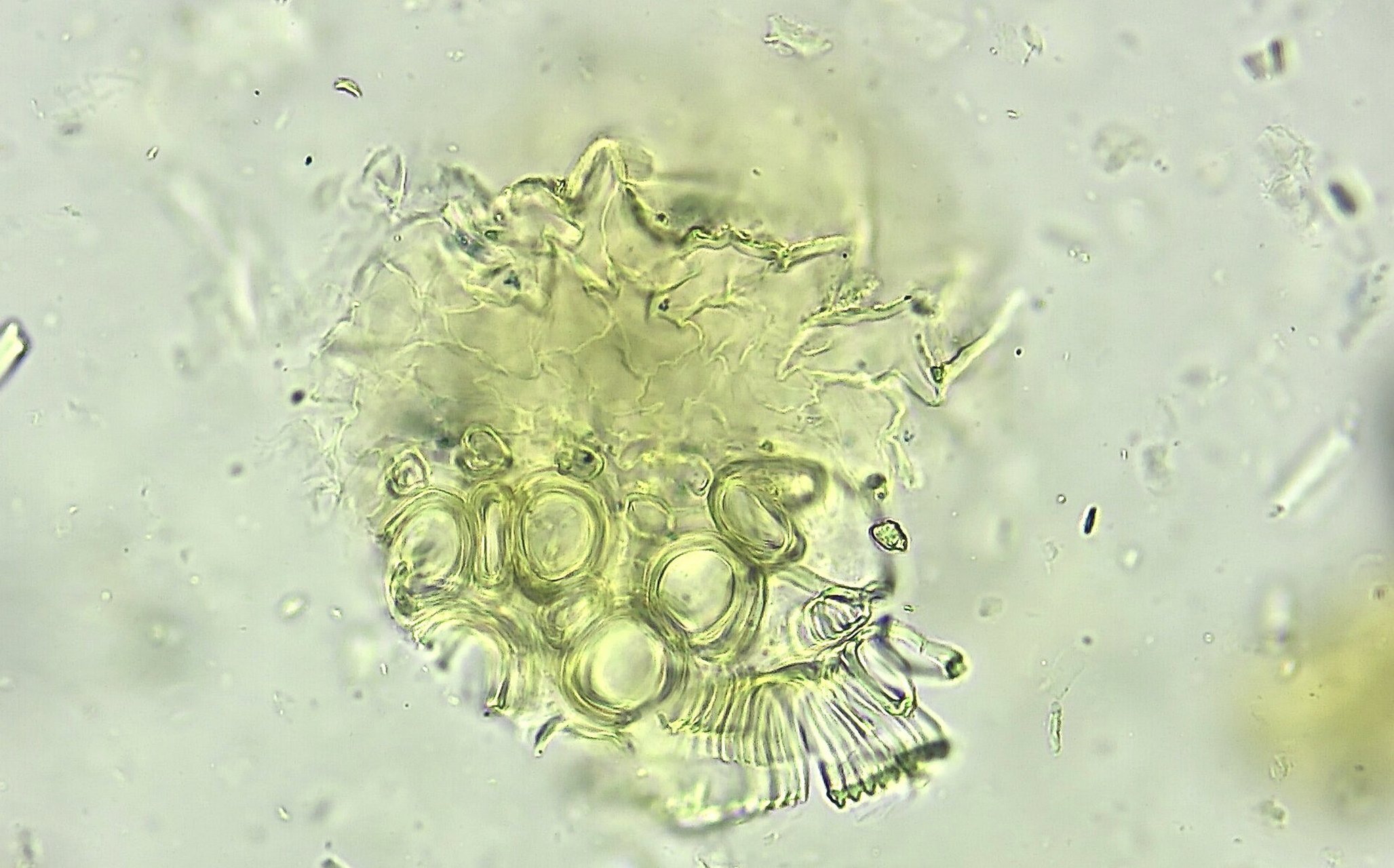 翻一翻以前的做的粉末显微鉴定-大青叶 大青叶来源于十字花科植物菘蓝