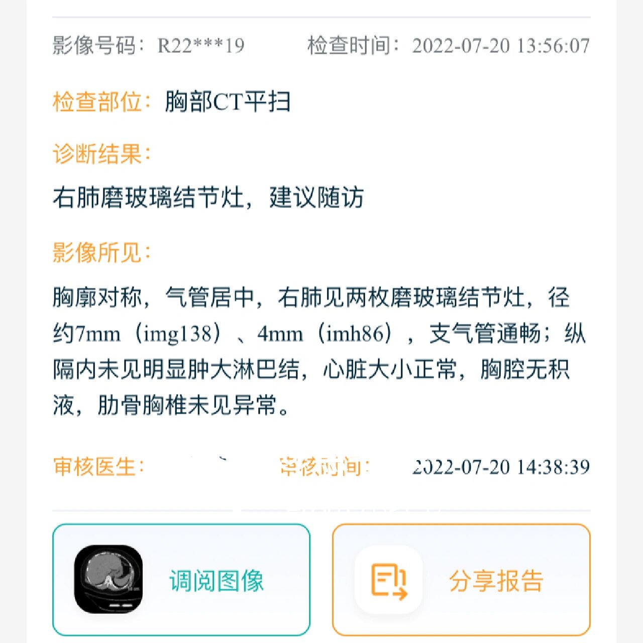 肺磨玻璃结节之中山医院王群教授篇