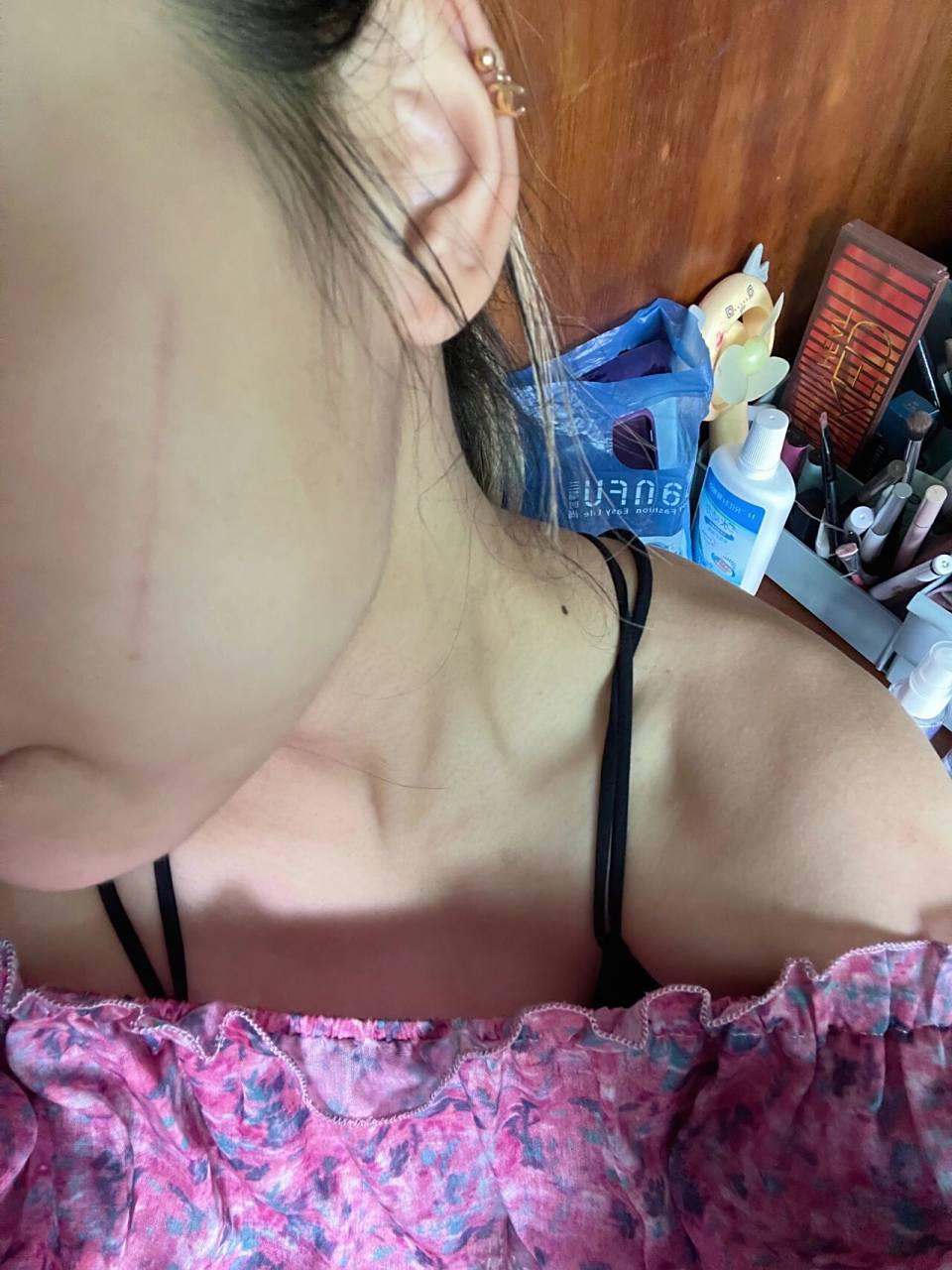 连续两天早上无缘无故起床都有划痕 睡觉首饰也都是摘下来的啊 什么