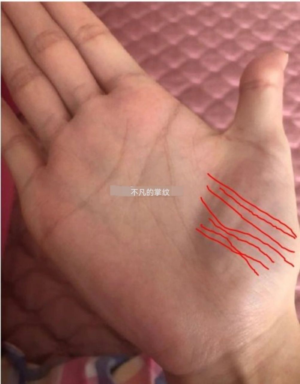 在金星丘的竖纹特别的多,而且比较清晰,就是俗称的暗财纹,虽然在财运