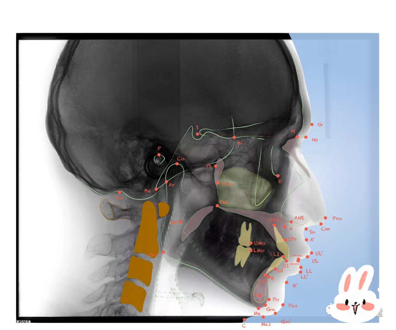 正畸必看之-头影测量解剖标志点及画法1 【正畸科进修】day 49 	 回乡