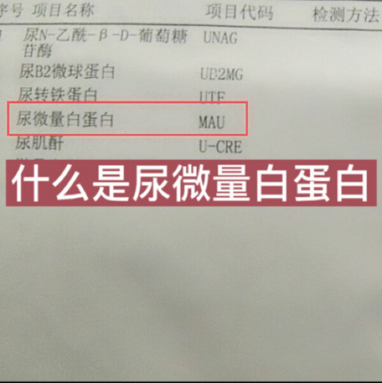 尿微量白蛋白是反应肾损害早期的金指标!