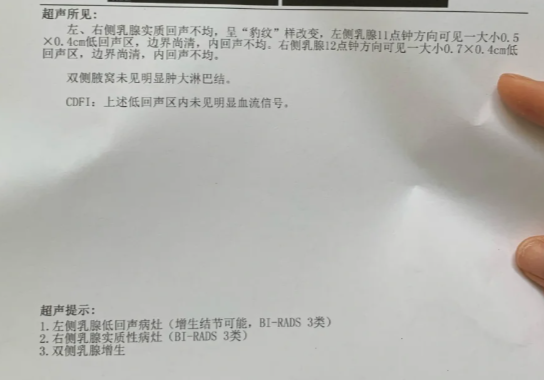 乳腺强化核磁并列为三大钼靶检查结果照片钼靶检查是怎么回事乳腺钼靶