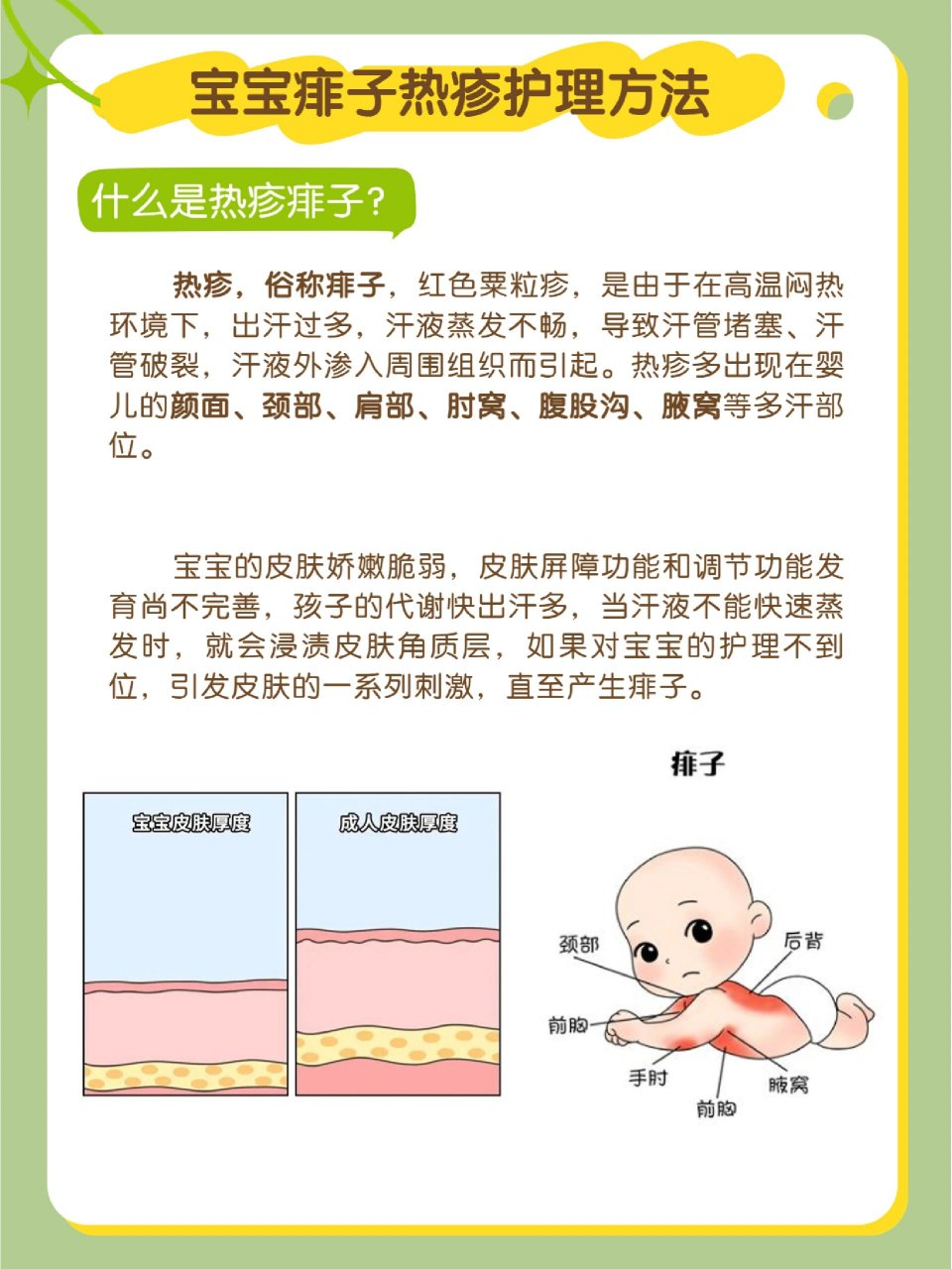 婴儿热痱怎么办图片