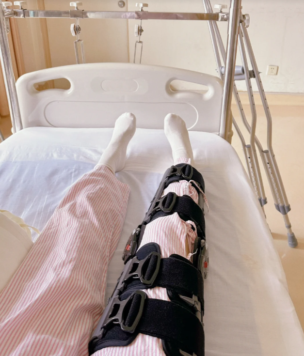 小腿软组织损伤后,局部会出现充血,水肿和渗出,肌肉纤维可能断裂