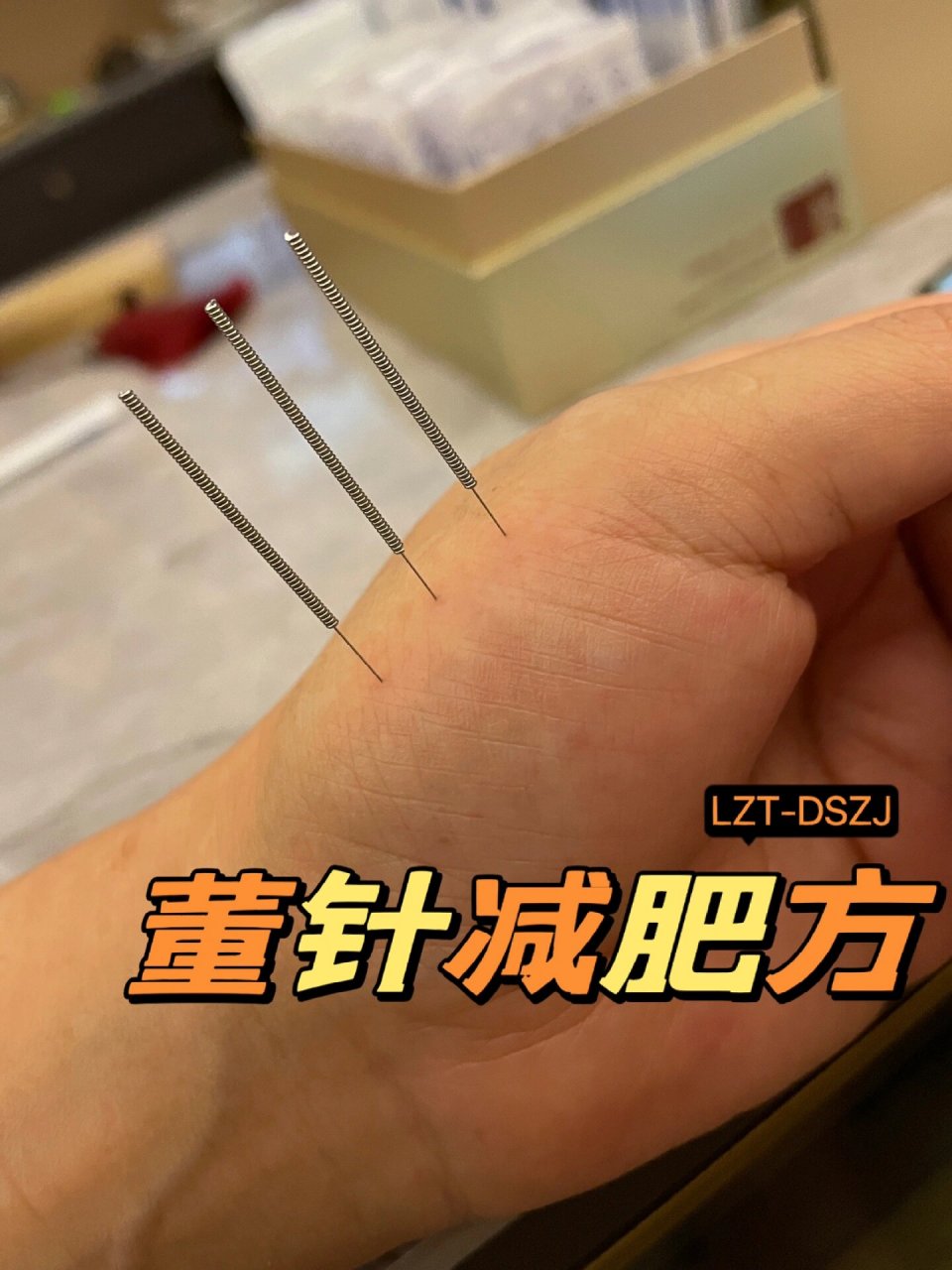 【董氏针灸·减肥方】 土水穴 土胃穴 四花穴 通肾通胃通背