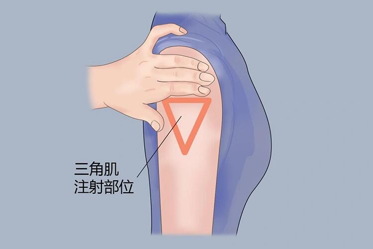 三角肌注射的正确位置图片