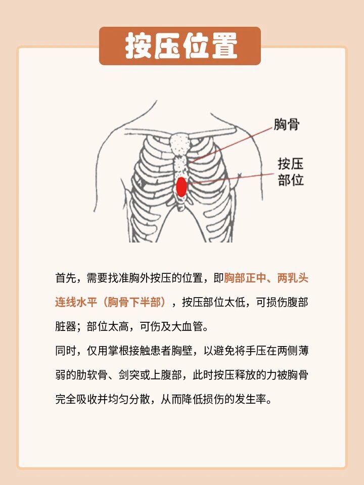 心肺复苏按压位置图图片