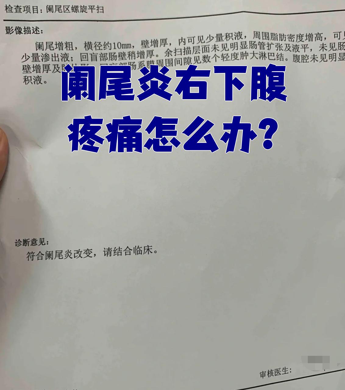 这是因为阑尾发炎化脓后刺激了右下腹的腹壁神经