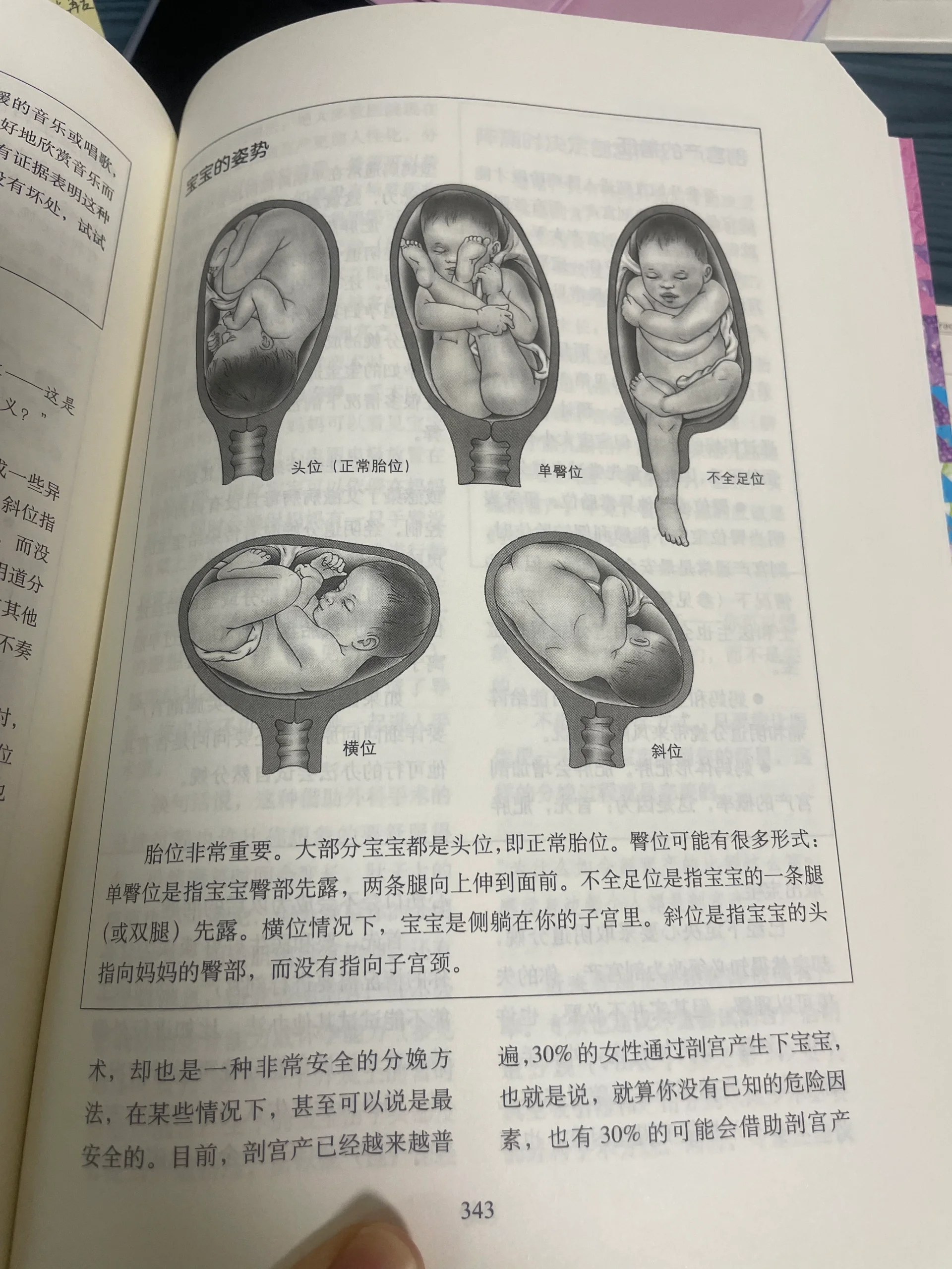 混合臀先露图片图片