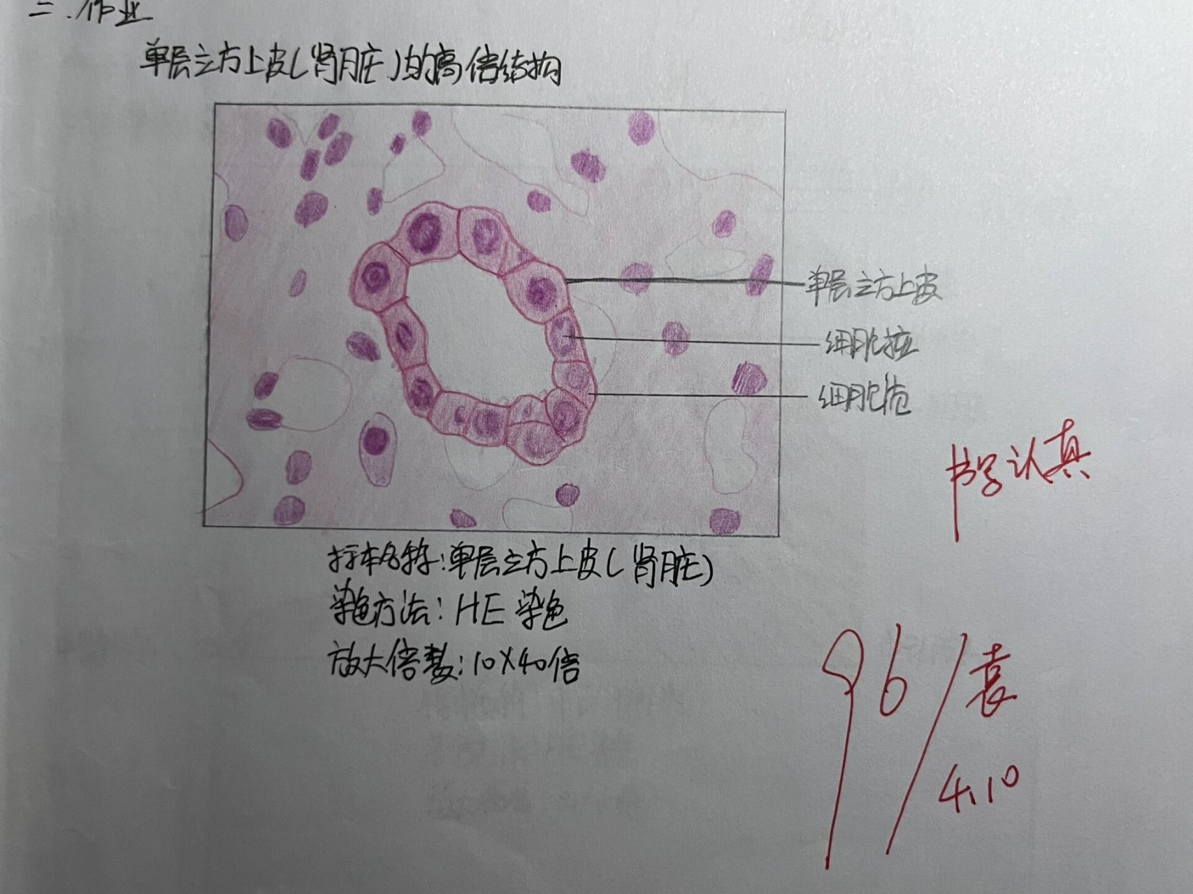 要结课了发一下,比较贴合实际不太算红蓝铅笔( p2 单层立方上皮 p3 中