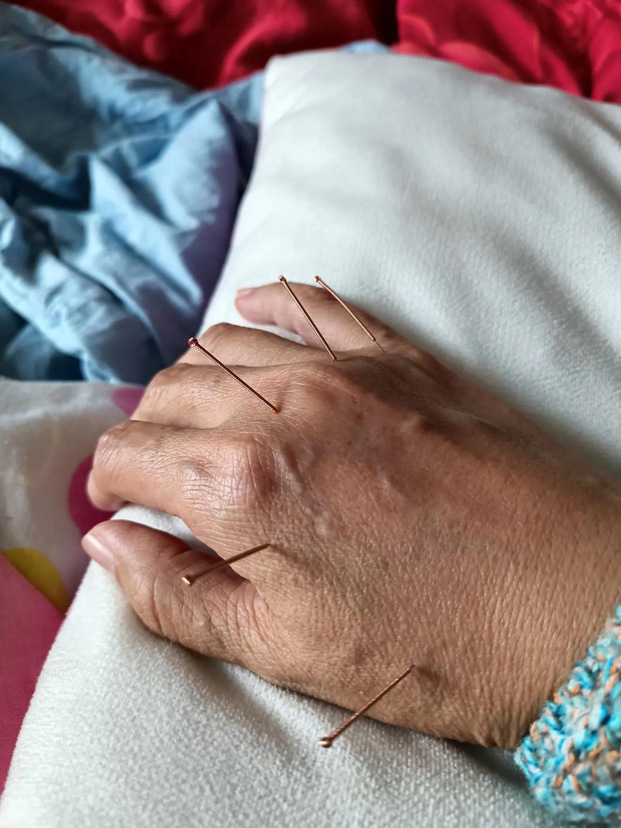 9度 无奈只好对自己下手 第二天只退到37