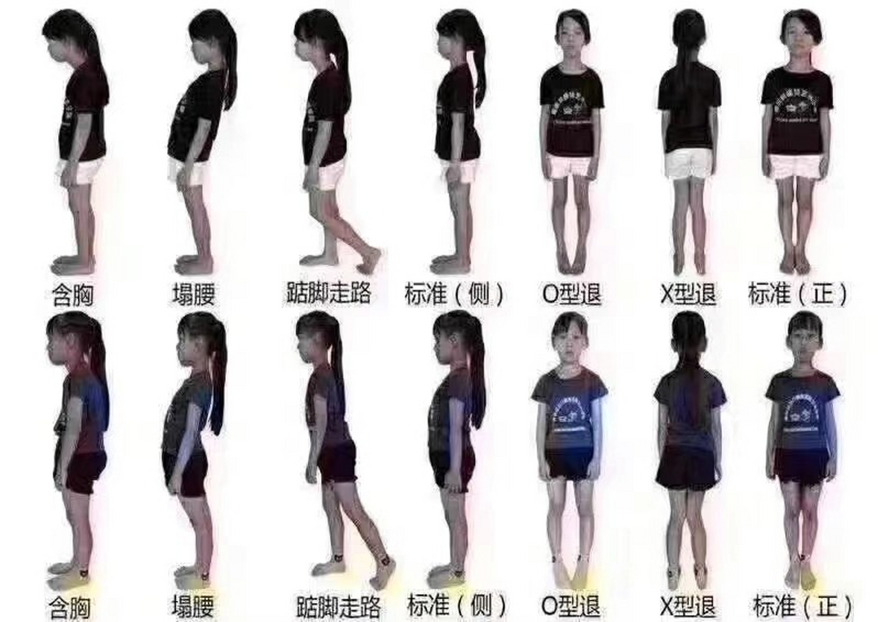 关注孩子不良体态. 8.8全民健身,体态调整 从孩子抓起. #健身