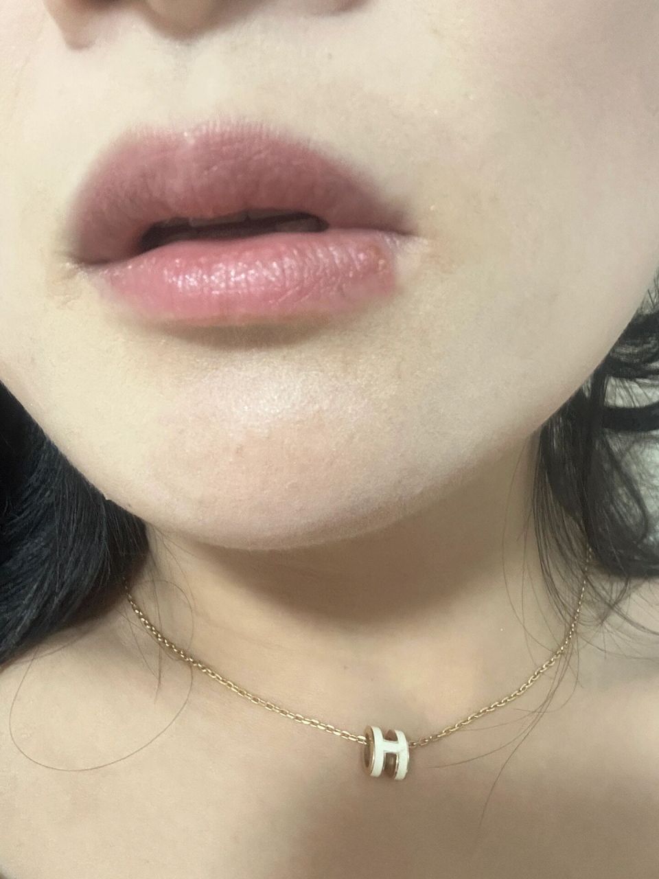 嘴唇账疱疹 用这药 简直神器 昨天晚上发了个疱疹 就立马找百度 买到