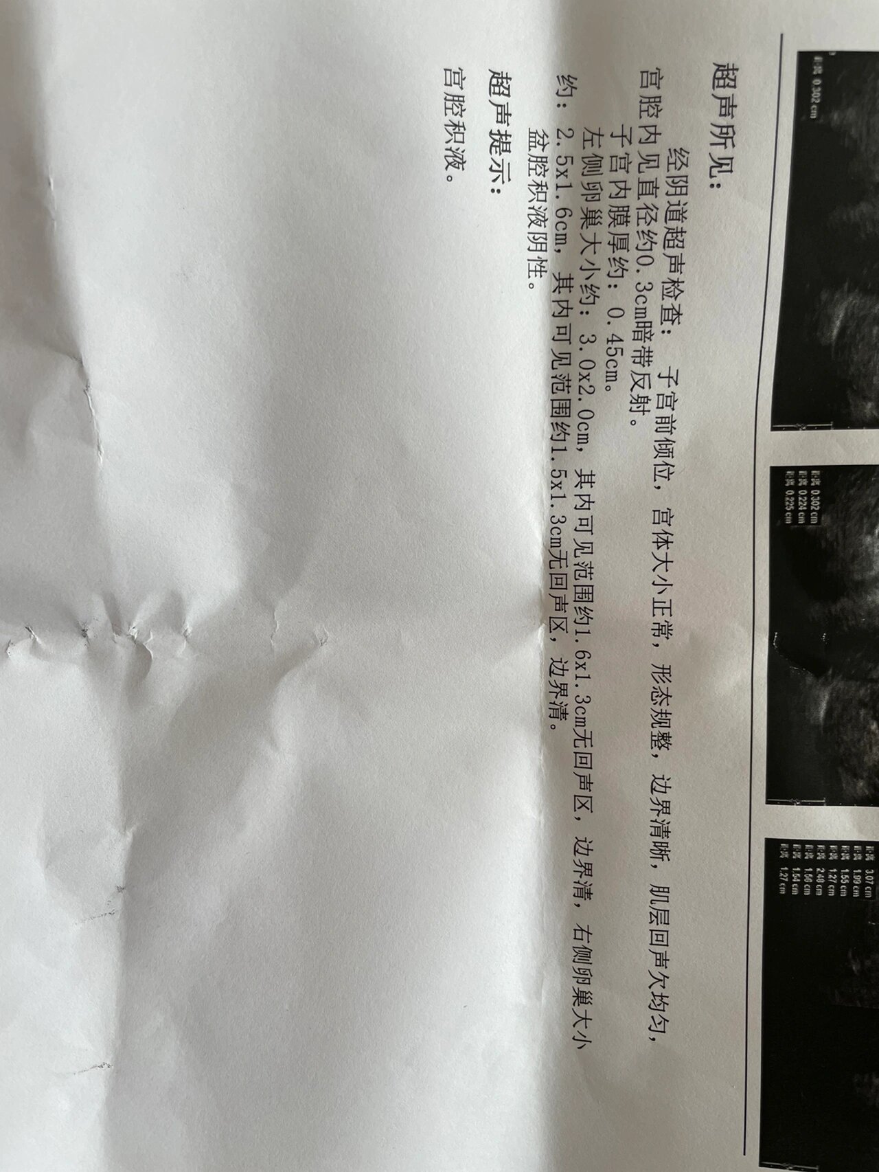 流产一个月的单子