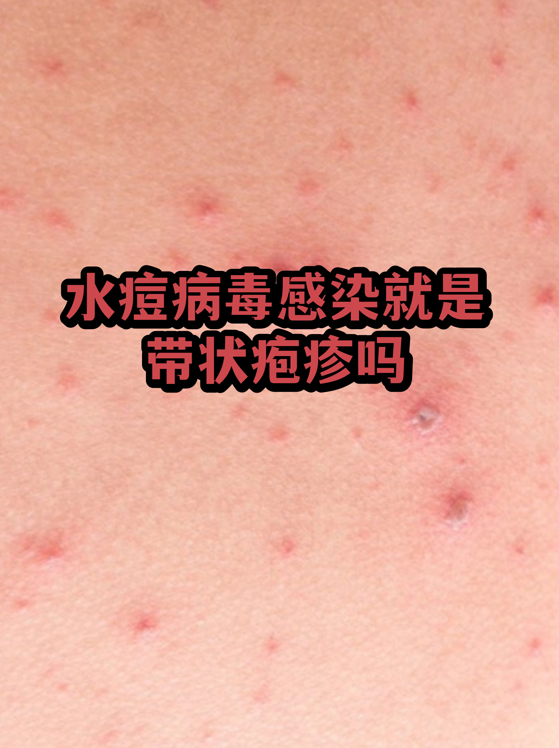  广东的病毒可能有三个来源是什么(广东的病毒叫什么)
