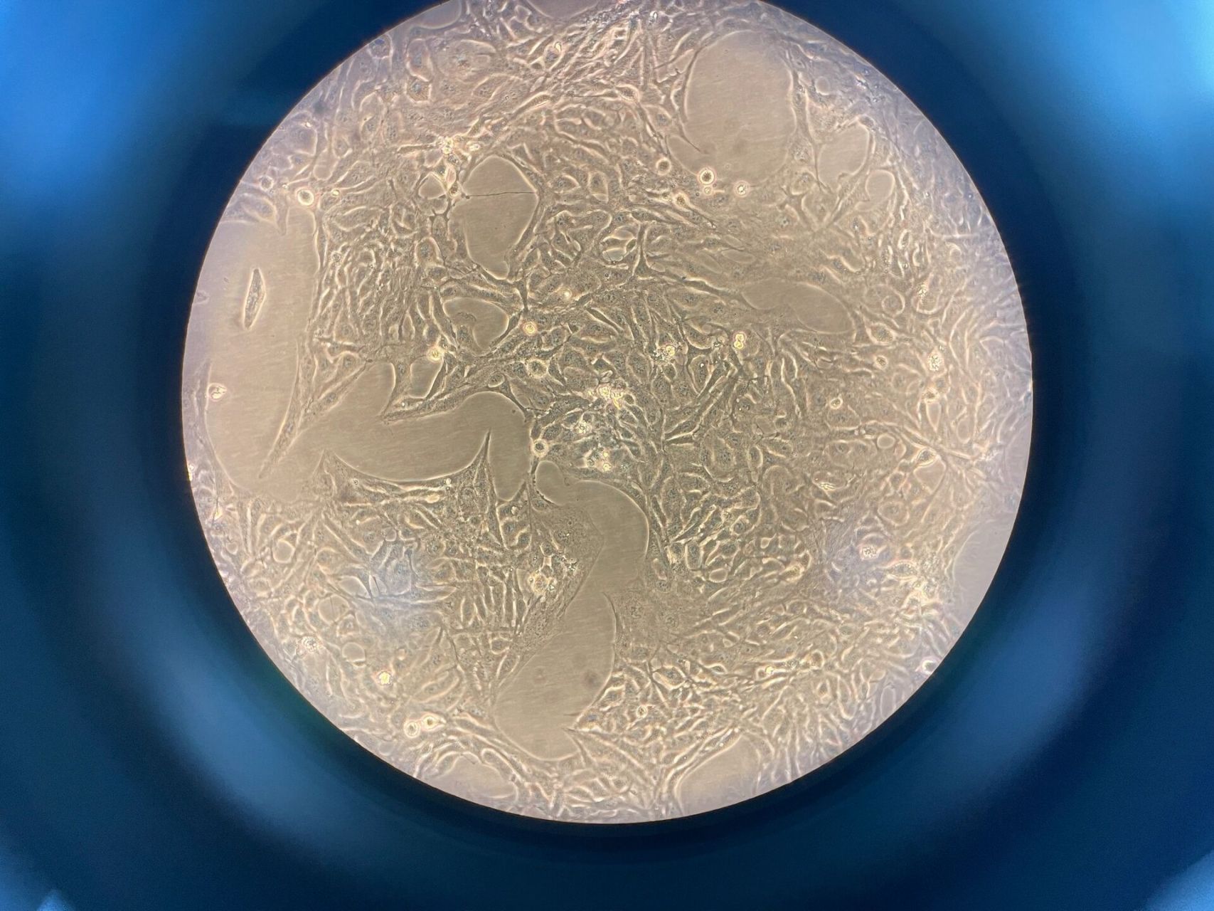 beas-2b细胞这样的形态是好的吗 刚开始养细胞 不知道beas-2b细胞这样