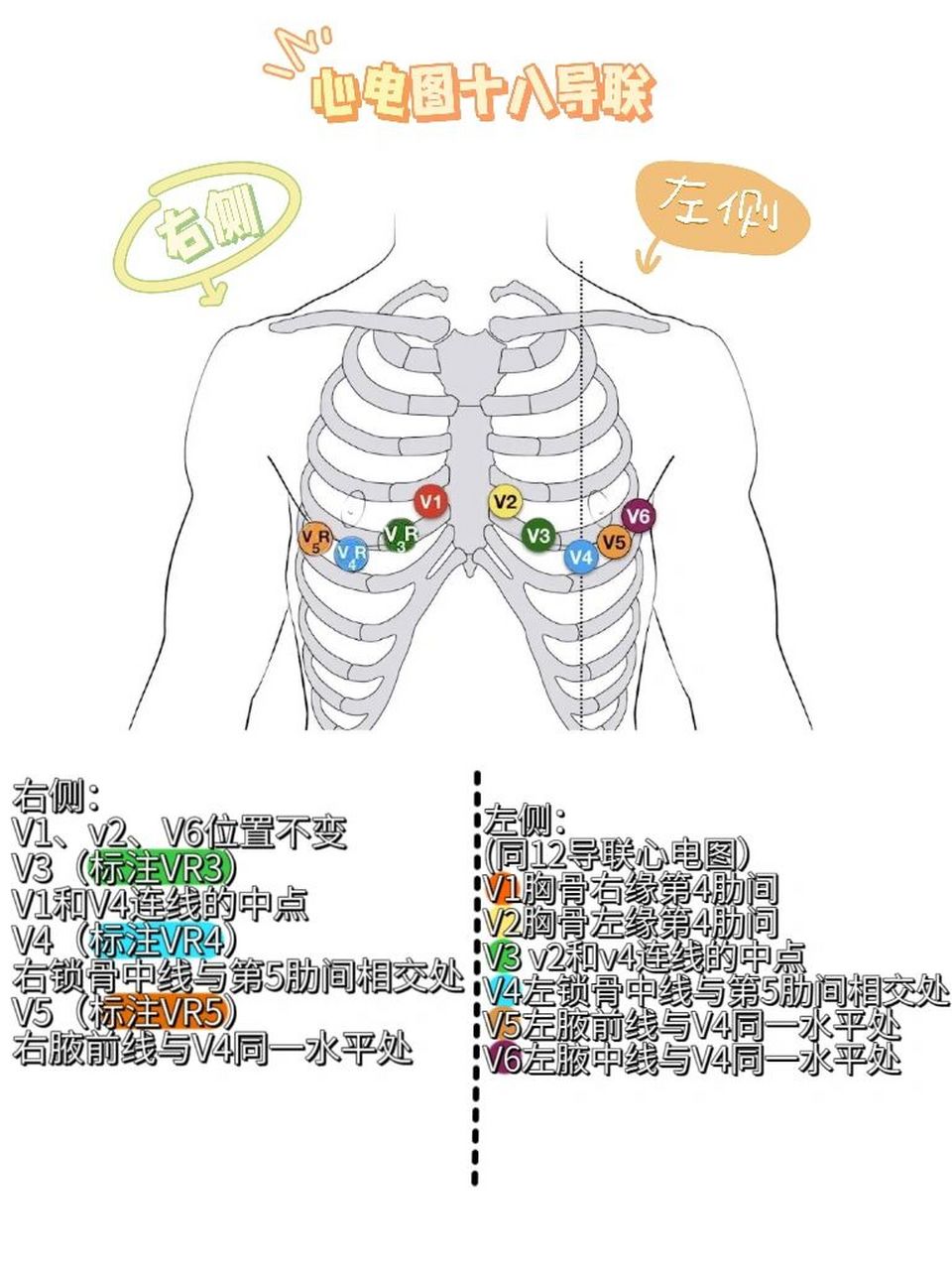 心电18导联的位置图片图片