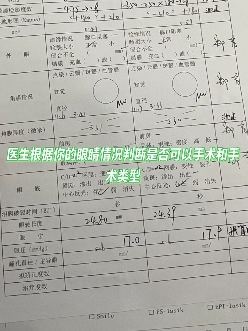 大坪醫院眼科97近視手術分享 耽擱了四個月,俺終於做完近視手術了!