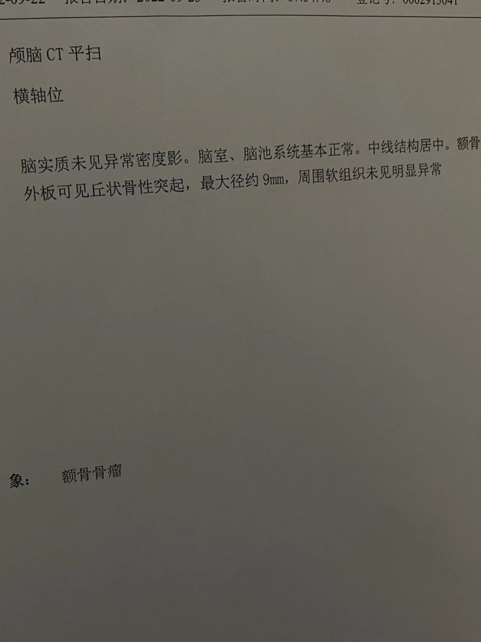颅骨骨瘤 额头骨质增生 准备把它去掉 好多年了,最近感觉变大了  影响