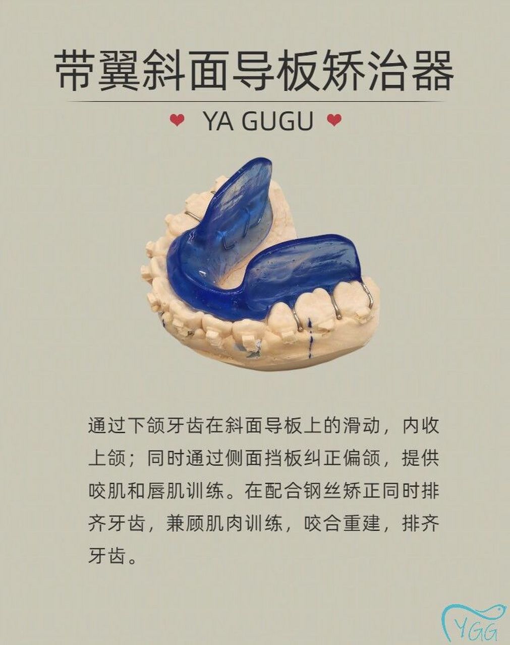 今日学习:带翼斜面导板矫治器 带翼斜面导板矫治器 通过下颌牙齿在