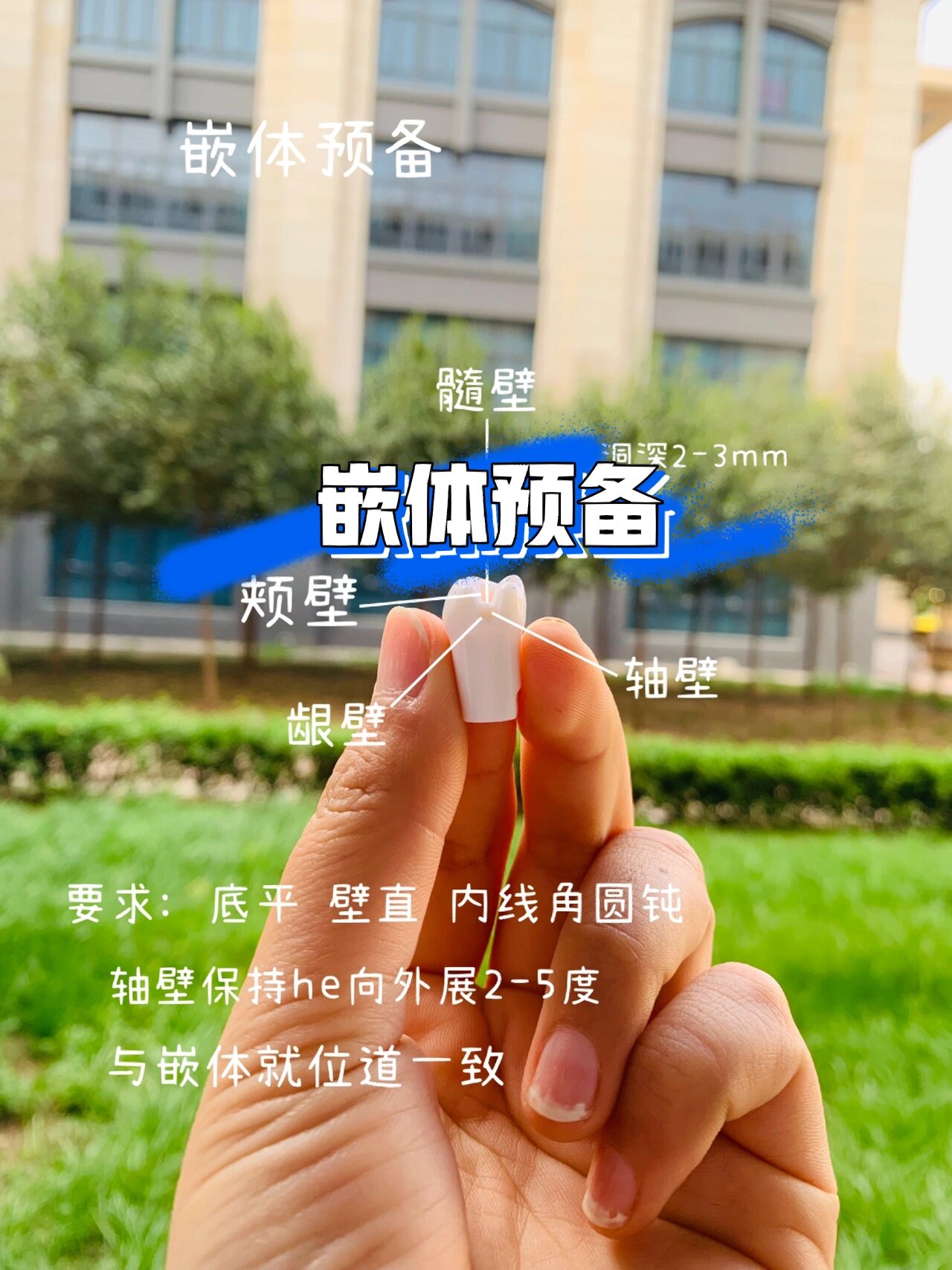 嵌体预备