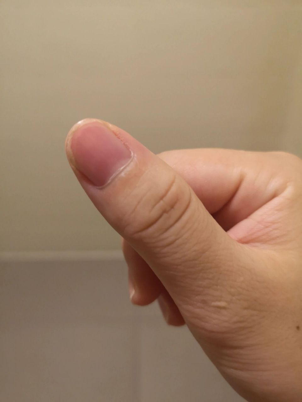 最近发现大拇指月牙都快没有了,不知道是不是被宝宝吸收了,又担心