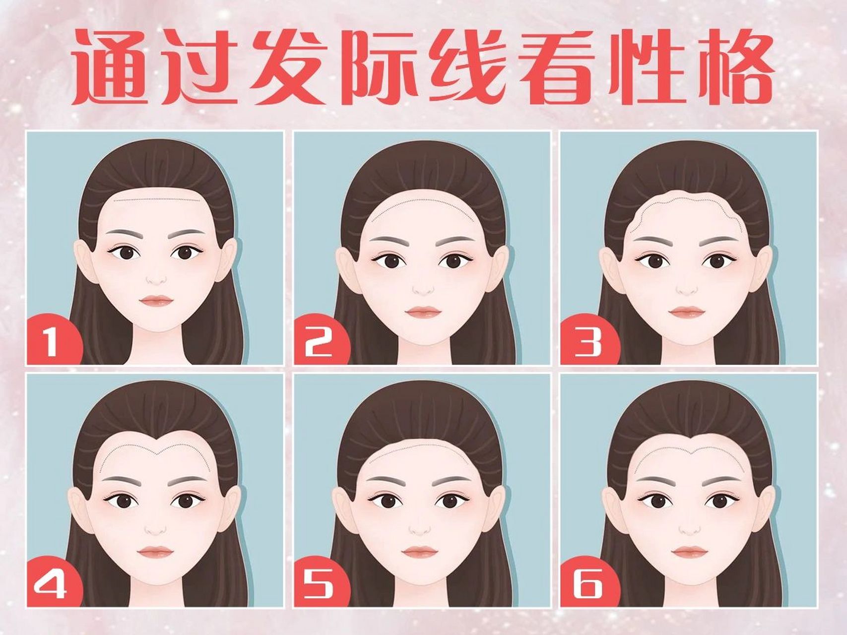 女性发际线类型图解图片