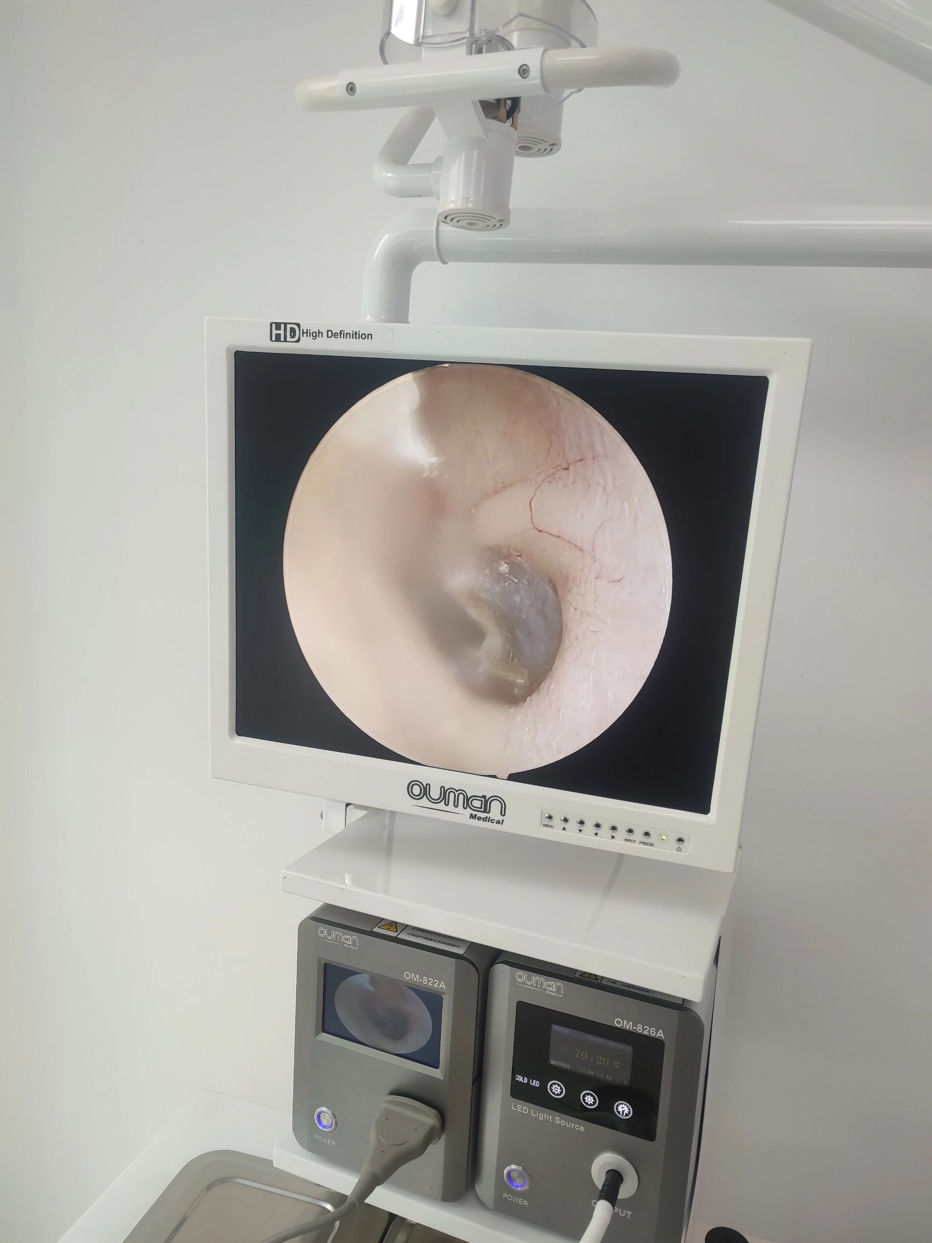 听力测试多少正常 耳朵测试听力临床上又称为纯音听阈检查,它是一种