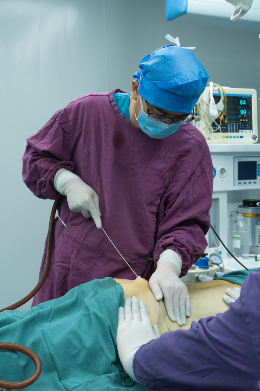 腰腹环吸# #吸脂# 腰腹环吸对比图