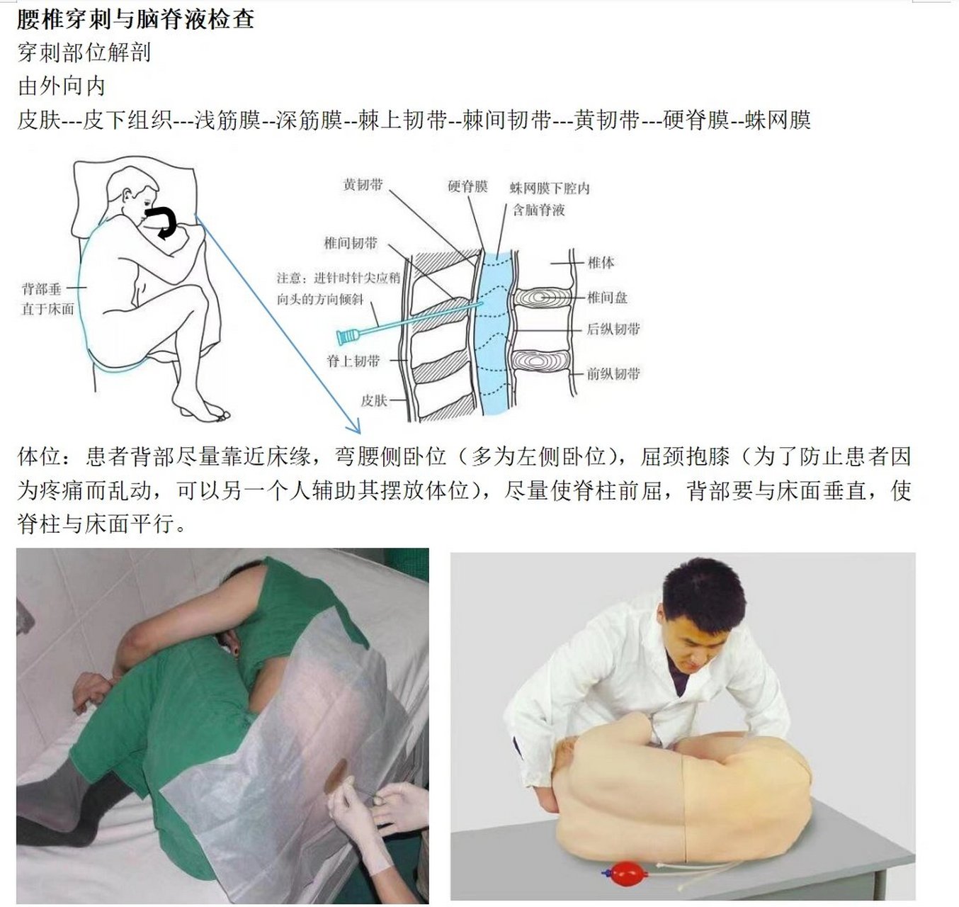 腰穿层次解剖图图片