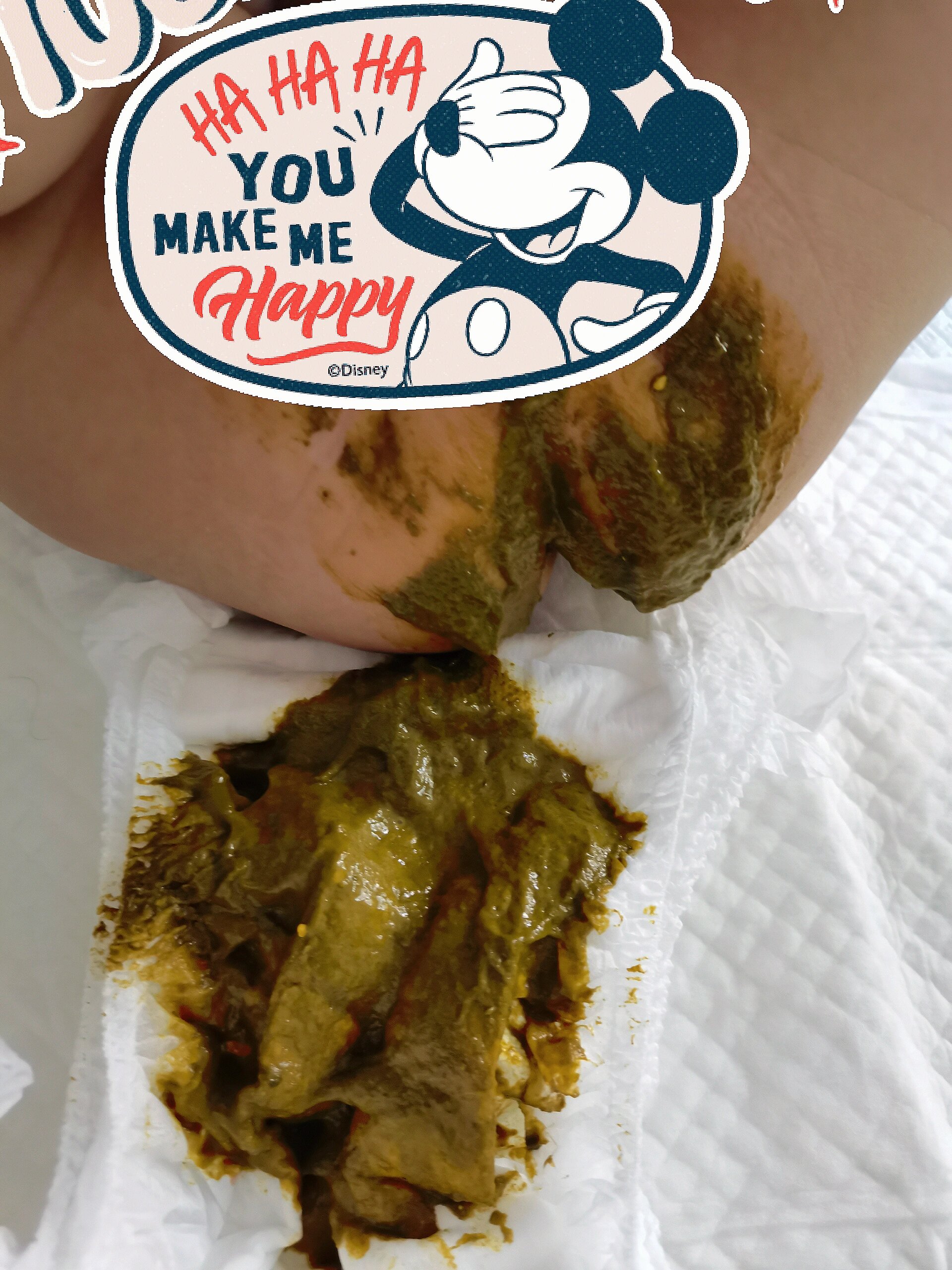 加辅食后宝宝五天没拉屎的后续来了啦