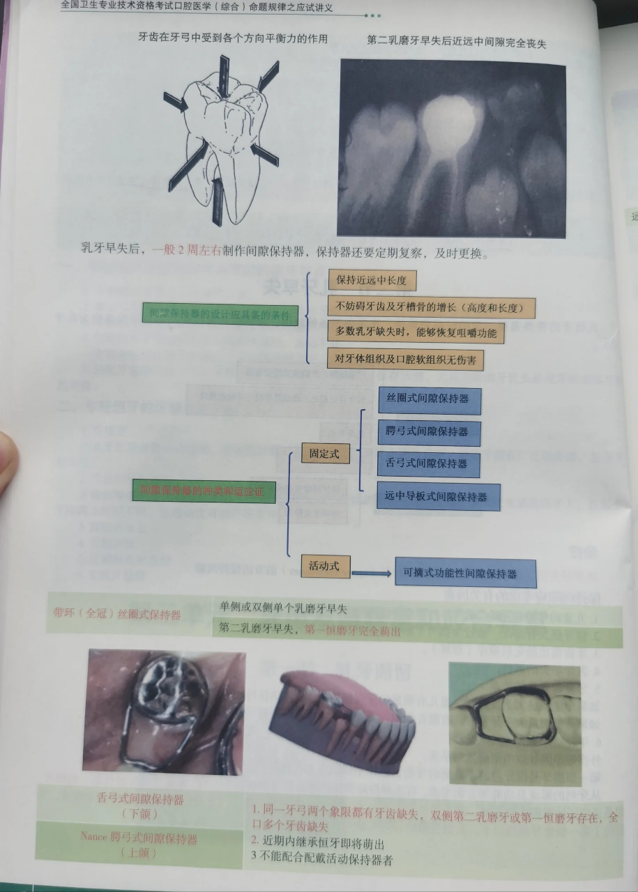 间隙保持器 弊端图片