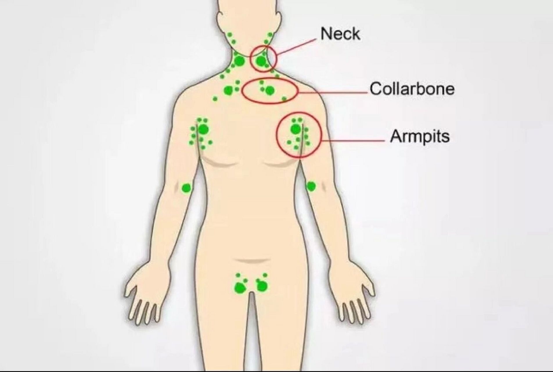 腋下淋巴结位置图片