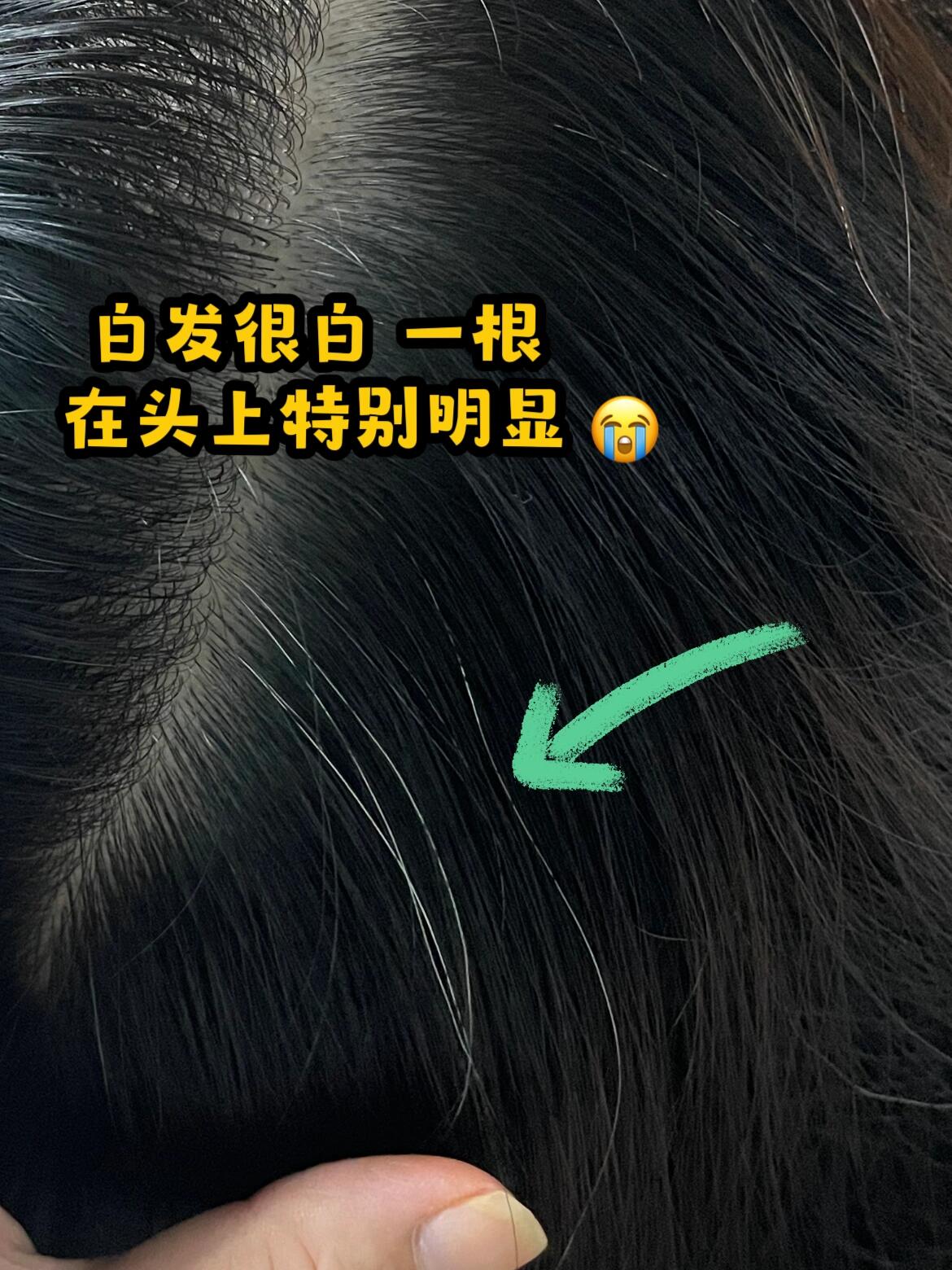 少白头就是养气血 少白发的姐妹一定要知道!白发的原因!