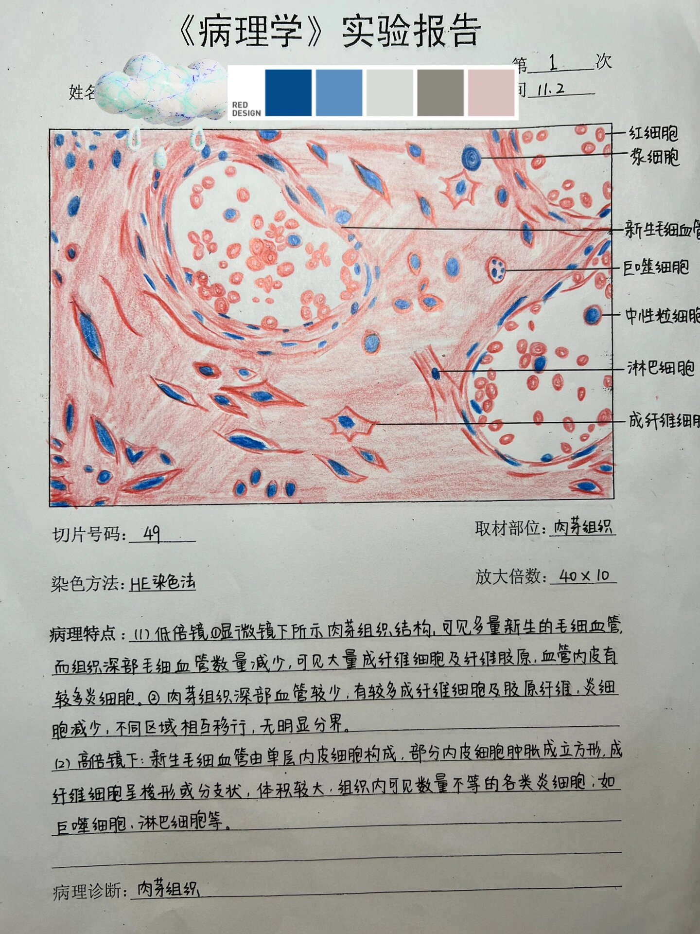 肉芽组织显微镜下图图片