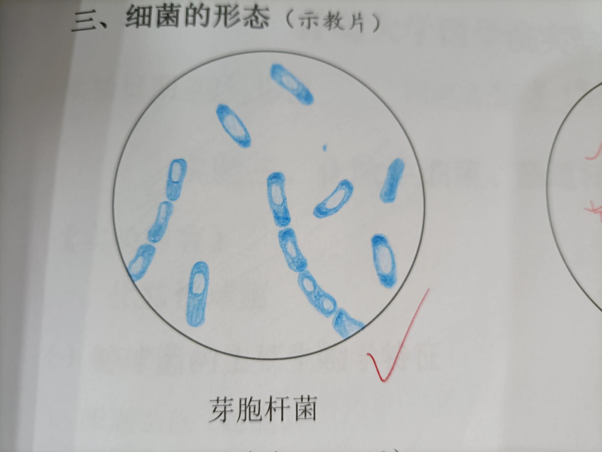 破伤风杆菌红蓝铅笔图片